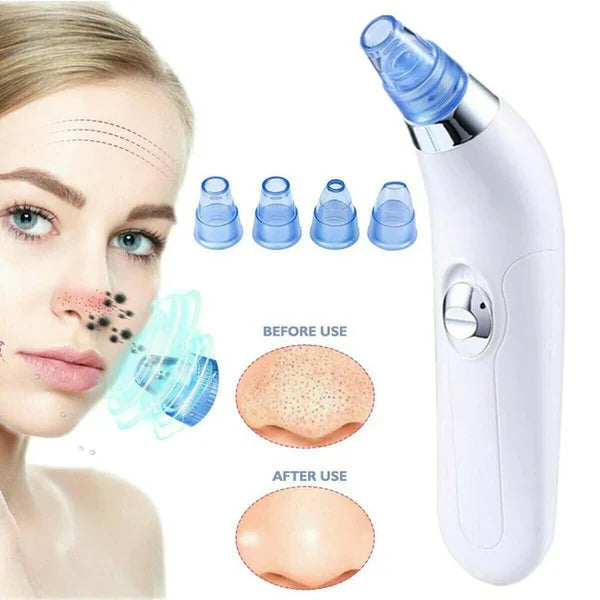 4 IN 1 Derma Suction Blackheads Remover & ACNE/OIL/PORE CLEANER